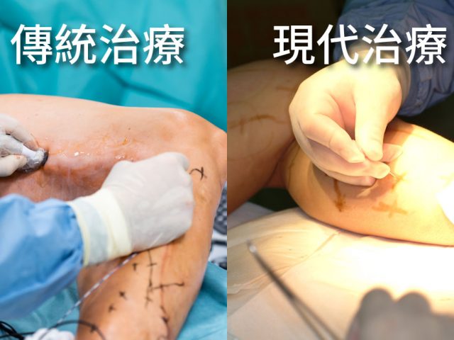 現代治療 vs 傳統治療